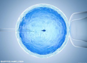 妇科微创
